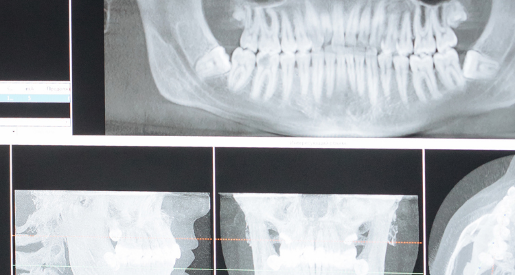 oral surgeon fairhope al