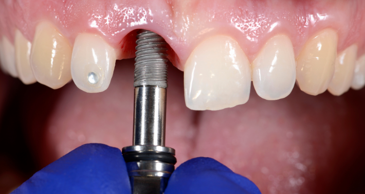 oral surgeon Fairhope AL